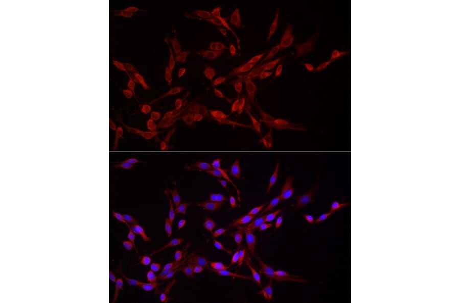 Immunofluorescence - Anti-DRP1 Antibody (A305696) - Antibodies.com