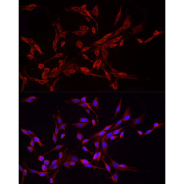 Immunofluorescence - Anti-DRP1 Antibody (A305696) - Antibodies.com