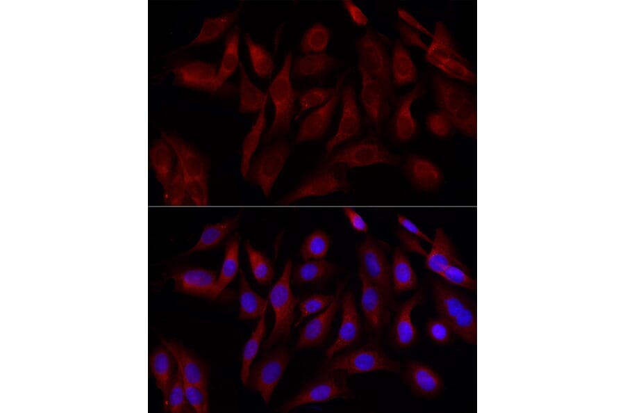 Immunofluorescence - Anti-DRP1 Antibody (A305696) - Antibodies.com