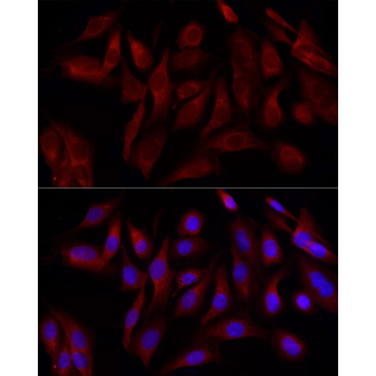 Immunofluorescence - Anti-DRP1 Antibody (A305696) - Antibodies.com