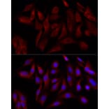 Immunofluorescence - Anti-DRP1 Antibody (A305696) - Antibodies.com