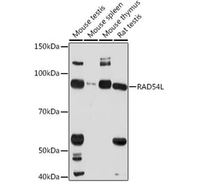 Western Blot - Anti-RAD54 Antibody (A305699) - Antibodies.com