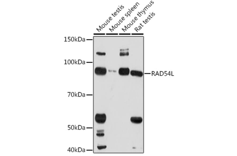 Western Blot - Anti-RAD54 Antibody (A305699) - Antibodies.com