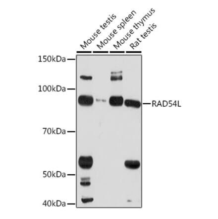 Western Blot - Anti-RAD54 Antibody (A305699) - Antibodies.com