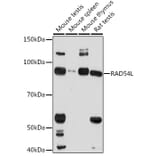 Western Blot - Anti-RAD54 Antibody (A305699) - Antibodies.com