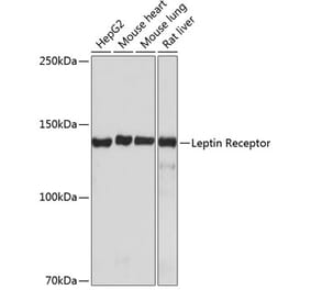 Western Blot - Anti-Leptin Receptor Antibody [ARC0454] (A305700) - Antibodies.com