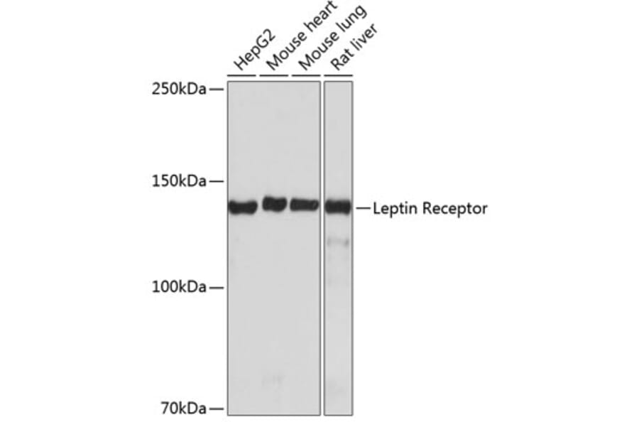 Western Blot - Anti-Leptin Receptor Antibody [ARC0454] (A305700) - Antibodies.com