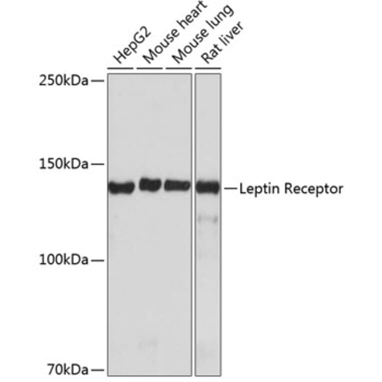 Western Blot - Anti-Leptin Receptor Antibody [ARC0454] (A305700) - Antibodies.com