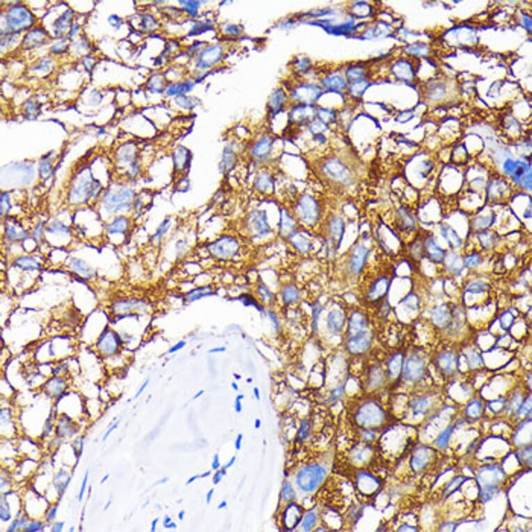 Immunohistochemistry - Anti-Leptin Receptor Antibody [ARC0454] (A305700) - Antibodies.com
