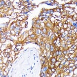 Immunohistochemistry - Anti-Leptin Receptor Antibody [ARC0454] (A305700) - Antibodies.com