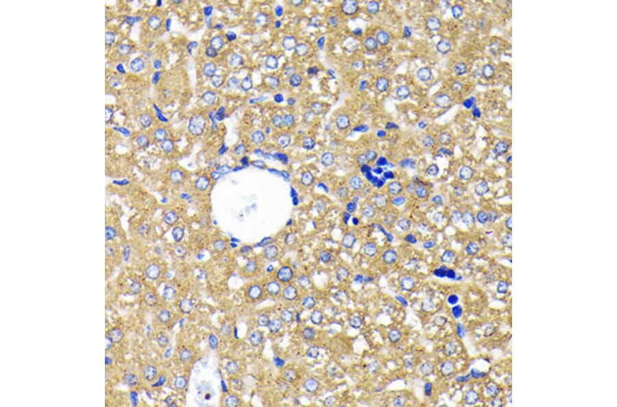 Immunohistochemistry - Anti-Leptin Receptor Antibody [ARC0454] (A305700) - Antibodies.com
