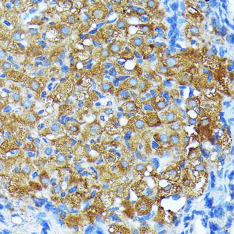 Immunohistochemistry - Anti-Leptin Receptor Antibody [ARC0454] (A305700) - Antibodies.com