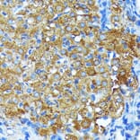 Immunohistochemistry - Anti-Leptin Receptor Antibody [ARC0454] (A305700) - Antibodies.com