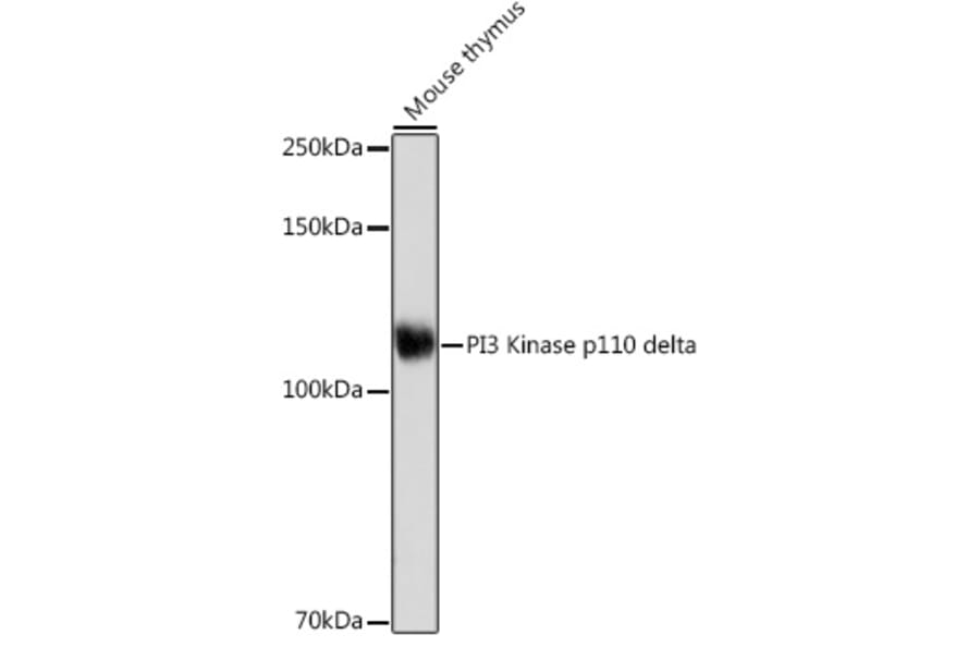 Western Blot - Anti-PI 3 Kinase p110 delta Antibody [ARC2268] (A305701) - Antibodies.com