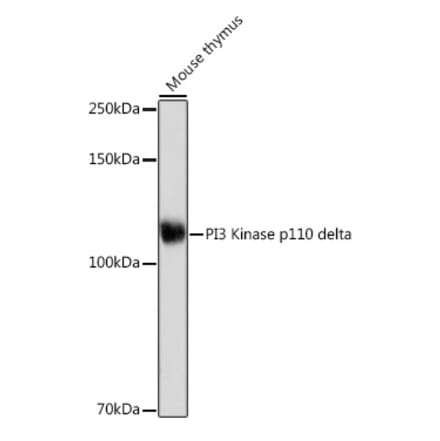 Western Blot - Anti-PI 3 Kinase p110 delta Antibody [ARC2268] (A305701) - Antibodies.com