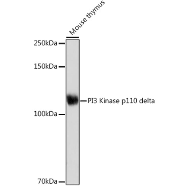 Western Blot - Anti-PI 3 Kinase p110 delta Antibody [ARC2268] (A305701) - Antibodies.com