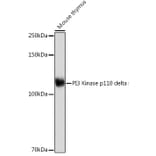 Western Blot - Anti-PI 3 Kinase p110 delta Antibody [ARC2268] (A305701) - Antibodies.com