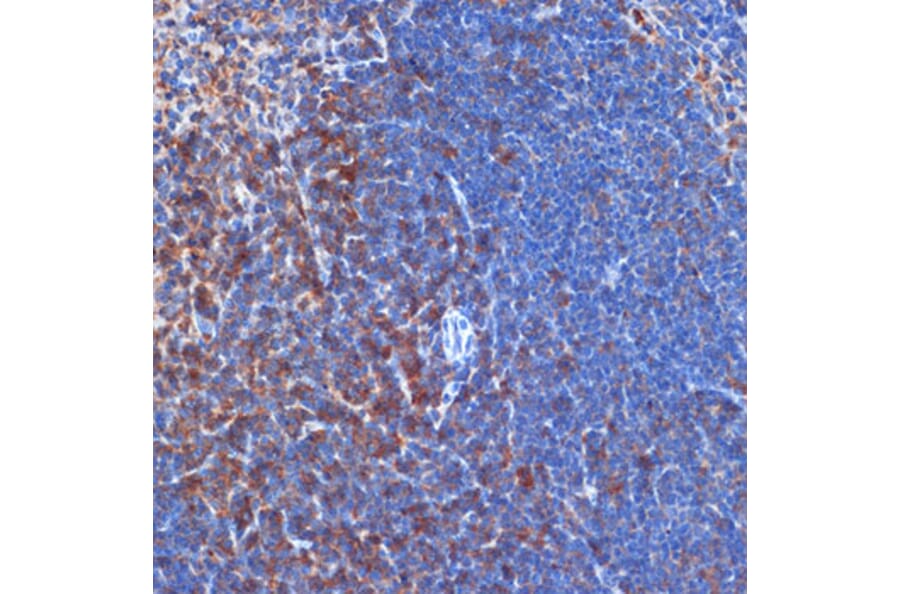 Immunohistochemistry - Anti-PI 3 Kinase p110 delta Antibody [ARC2268] (A305701) - Antibodies.com