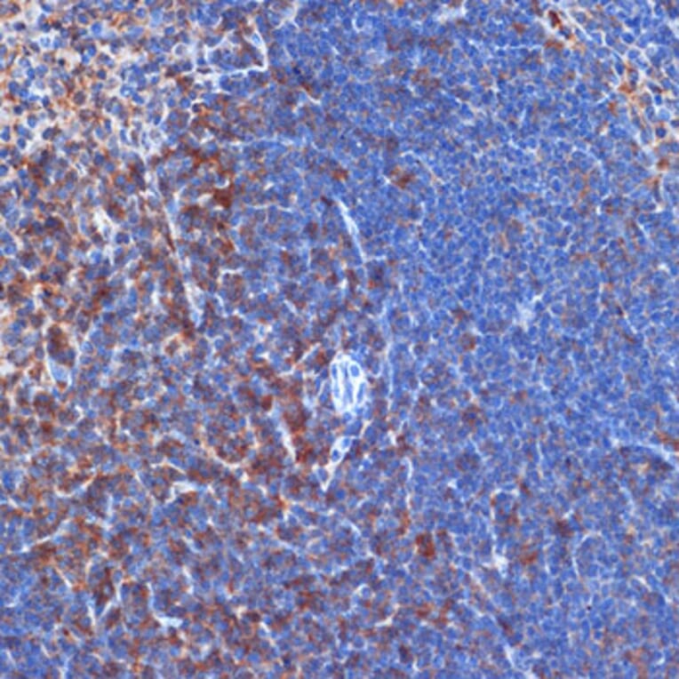 Immunohistochemistry - Anti-PI 3 Kinase p110 delta Antibody [ARC2268] (A305701) - Antibodies.com
