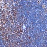 Immunohistochemistry - Anti-PI 3 Kinase p110 delta Antibody [ARC2268] (A305701) - Antibodies.com