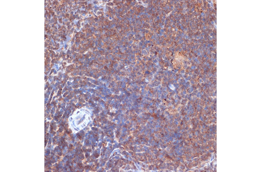 Immunohistochemistry - Anti-PI 3 Kinase p110 delta Antibody [ARC2268] (A305701) - Antibodies.com