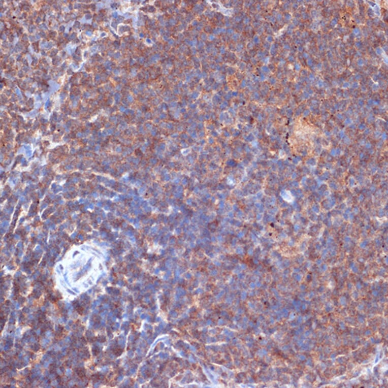 Immunohistochemistry - Anti-PI 3 Kinase p110 delta Antibody [ARC2268] (A305701) - Antibodies.com