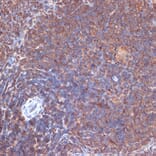Immunohistochemistry - Anti-PI 3 Kinase p110 delta Antibody [ARC2268] (A305701) - Antibodies.com