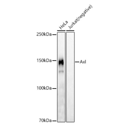 Western Blot - Anti-Axl Antibody [ARC53013] (A305702) - Antibodies.com