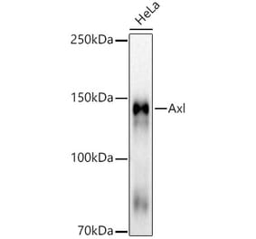 Western Blot - Anti-Axl Antibody [ARC53006] (A305703) - Antibodies.com