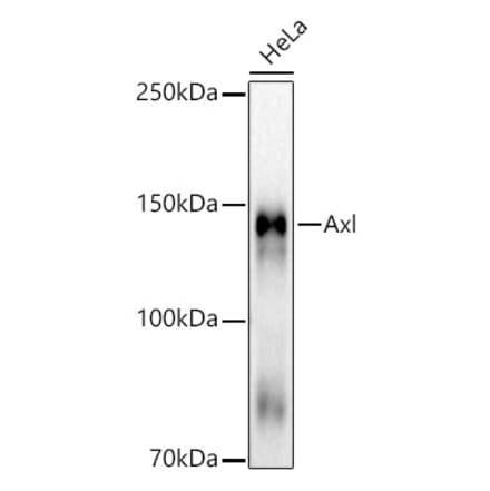 Western Blot - Anti-Axl Antibody [ARC53006] (A305703) - Antibodies.com