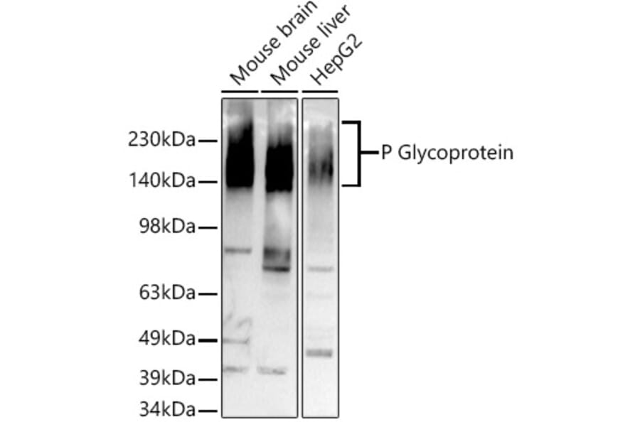 Western Blot - Anti-P Glycoprotein Antibody [ARC0470] (A305706) - Antibodies.com