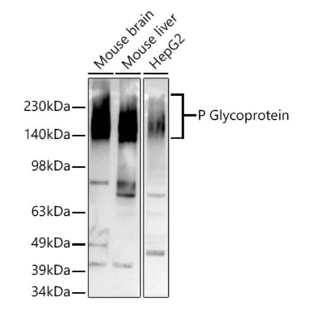 Western Blot - Anti-P Glycoprotein Antibody [ARC0470] (A305706) - Antibodies.com