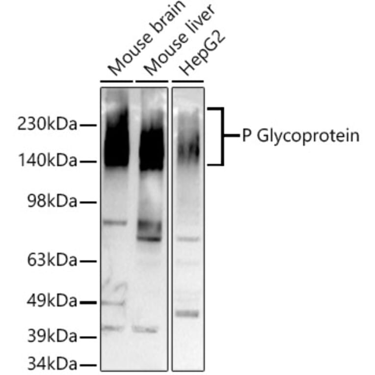 Western Blot - Anti-P Glycoprotein Antibody [ARC0470] (A305706) - Antibodies.com