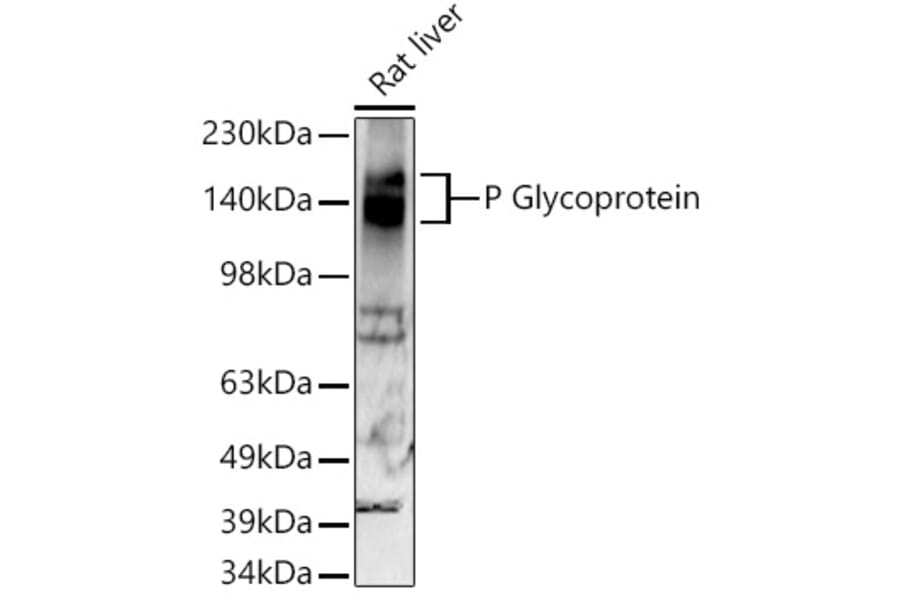 Western Blot - Anti-P Glycoprotein Antibody [ARC0470] (A305706) - Antibodies.com