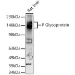 Western Blot - Anti-P Glycoprotein Antibody [ARC0470] (A305706) - Antibodies.com