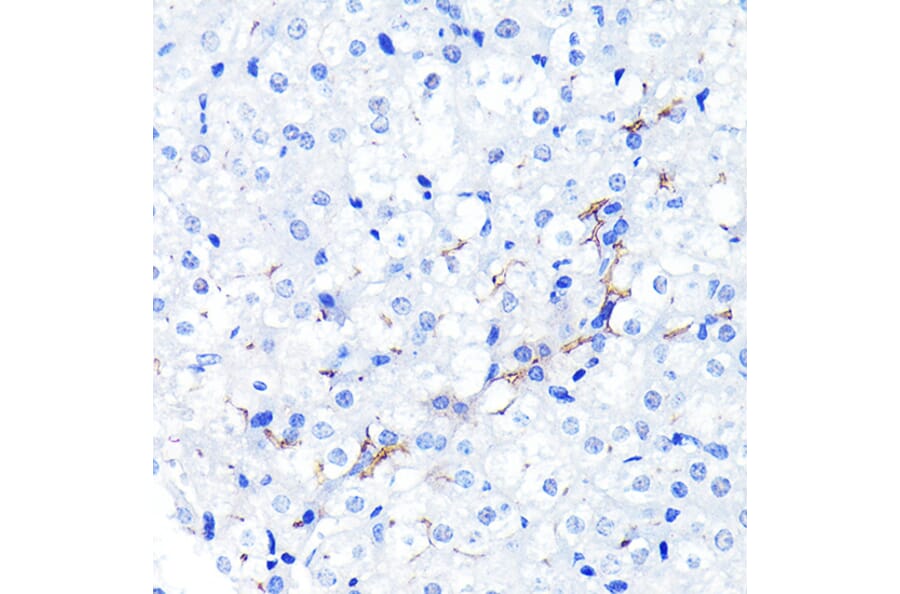 Immunohistochemistry - Anti-P Glycoprotein Antibody [ARC0470] (A305706) - Antibodies.com