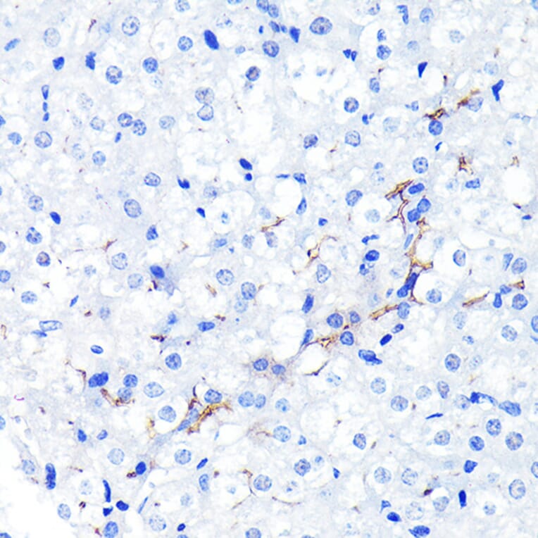 Immunohistochemistry - Anti-P Glycoprotein Antibody [ARC0470] (A305706) - Antibodies.com