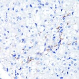 Immunohistochemistry - Anti-P Glycoprotein Antibody [ARC0470] (A305706) - Antibodies.com