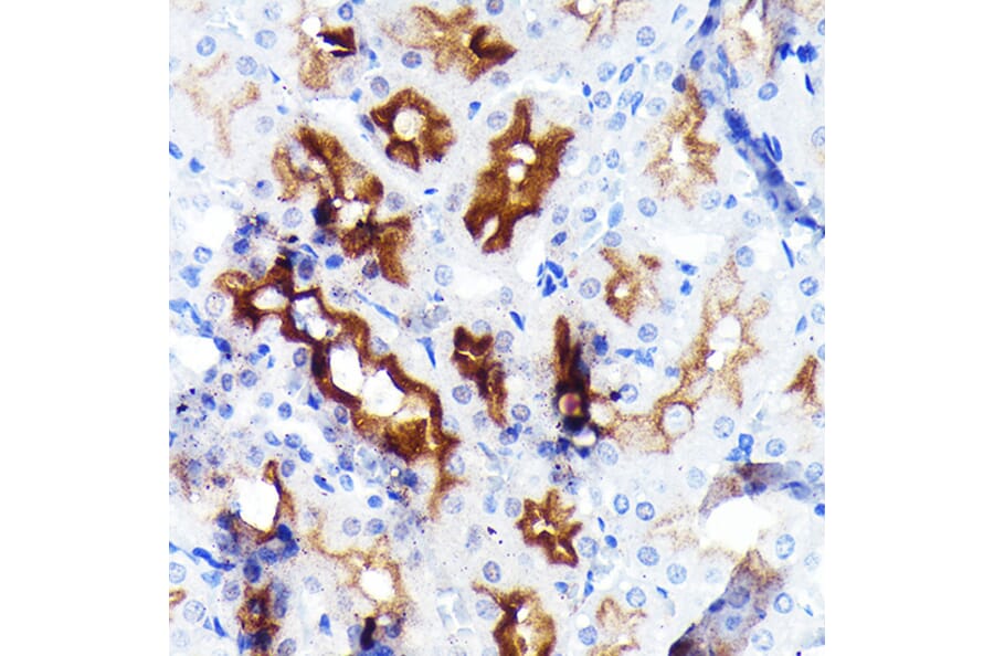 Immunohistochemistry - Anti-P Glycoprotein Antibody [ARC0470] (A305706) - Antibodies.com