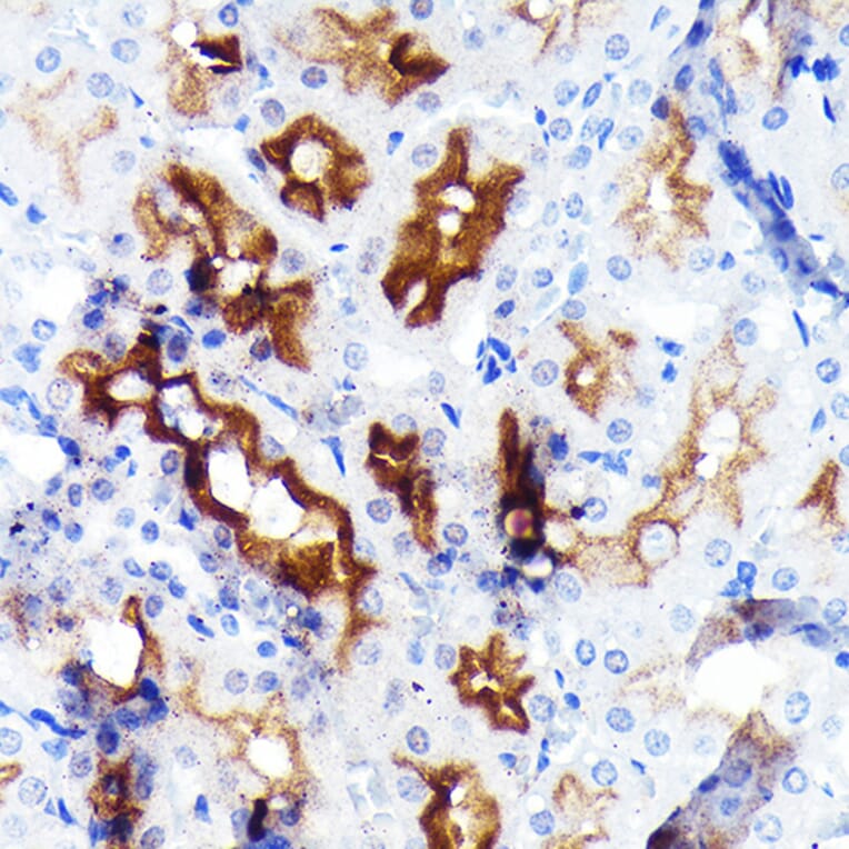 Immunohistochemistry - Anti-P Glycoprotein Antibody [ARC0470] (A305706) - Antibodies.com