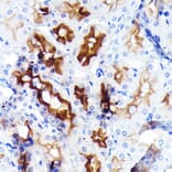 Immunohistochemistry - Anti-P Glycoprotein Antibody [ARC0470] (A305706) - Antibodies.com