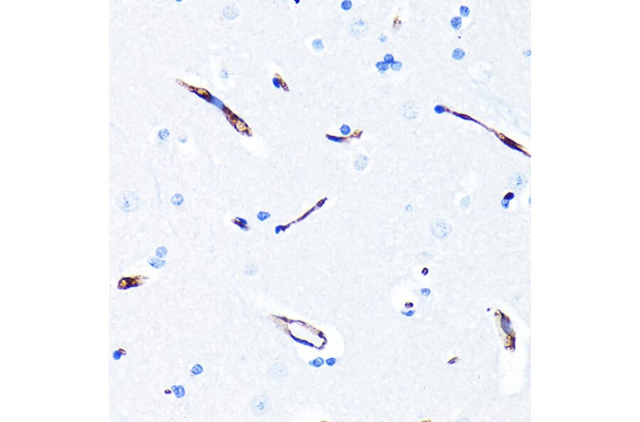 Immunohistochemistry - Anti-P Glycoprotein Antibody [ARC0470] (A305706) - Antibodies.com