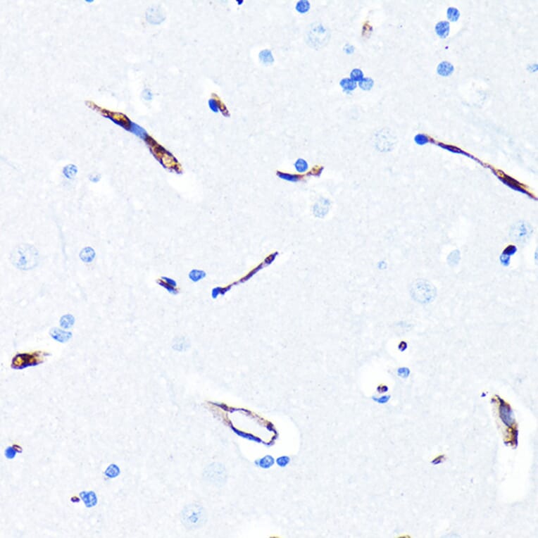 Immunohistochemistry - Anti-P Glycoprotein Antibody [ARC0470] (A305706) - Antibodies.com