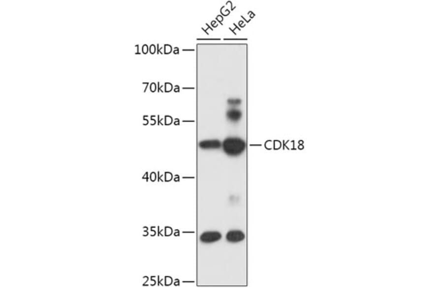 Western Blot - Anti-PCTAIRE3 Antibody (A305707) - Antibodies.com