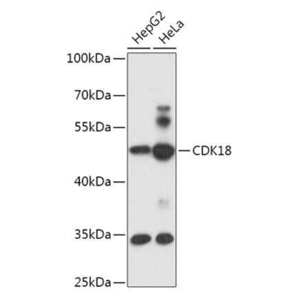 Western Blot - Anti-PCTAIRE3 Antibody (A305707) - Antibodies.com