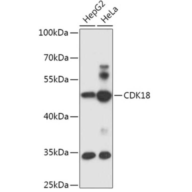 Western Blot - Anti-PCTAIRE3 Antibody (A305707) - Antibodies.com