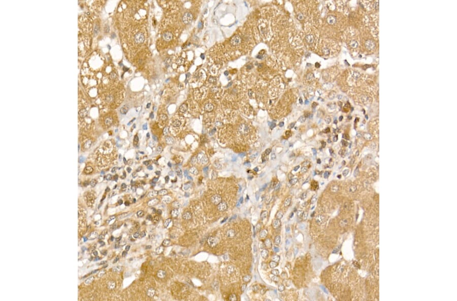 Immunohistochemistry - Anti-CK1 epsilon Antibody (A305708) - Antibodies.com