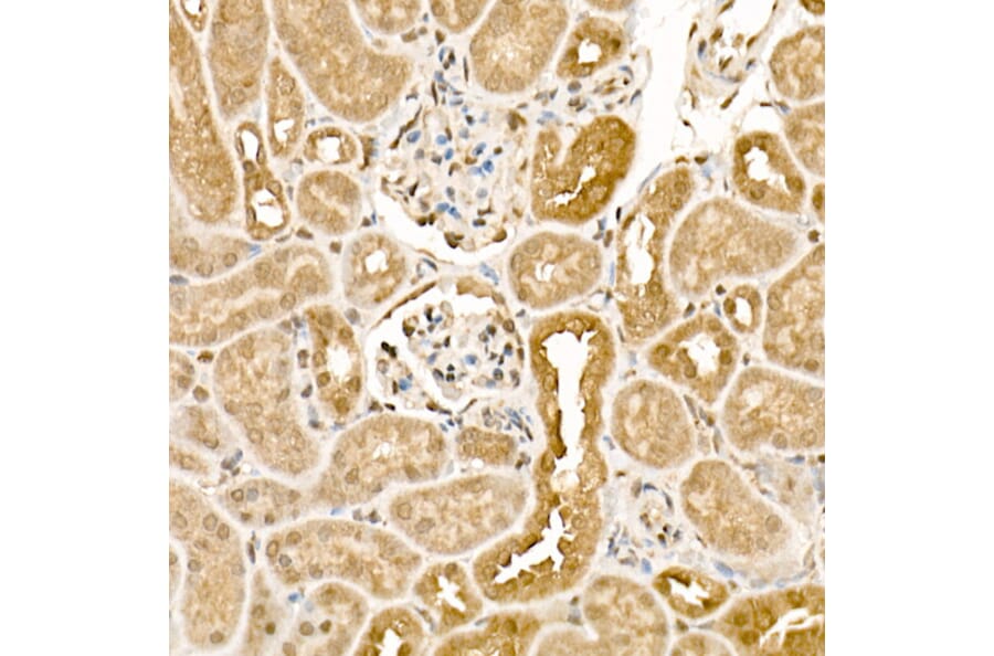 Immunohistochemistry - Anti-CK1 epsilon Antibody (A305708) - Antibodies.com