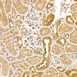Immunohistochemistry - Anti-CK1 epsilon Antibody (A305708) - Antibodies.com