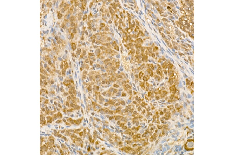 Immunohistochemistry - Anti-CK1 epsilon Antibody (A305708) - Antibodies.com